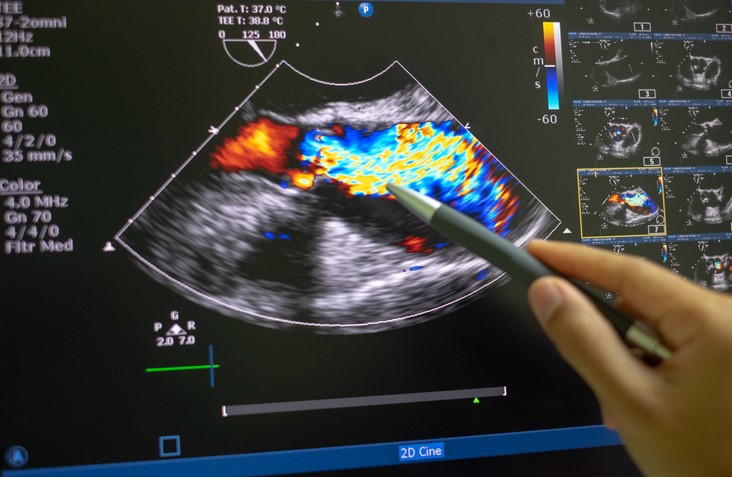 Deep learning opens doors for next-generation ultrasounds