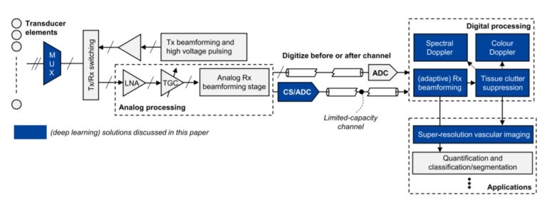 Deep Learning Opens Doors For Next-generation Ultrasounds | Innovate