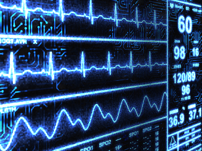 Chemosensory EEG Signals Identify Patients with Parkinson’s Disease